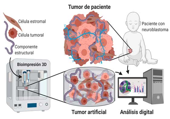 Tumor del paciente