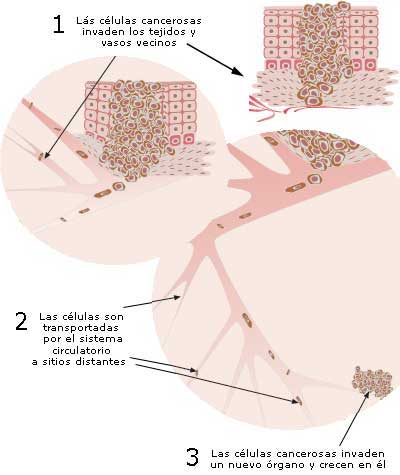 Cómo se origina el cáncer y se extiende