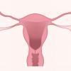 Día Mundial del Cáncer de Ovario
