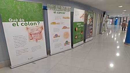Exposición sobre el cáncer de colon y recto