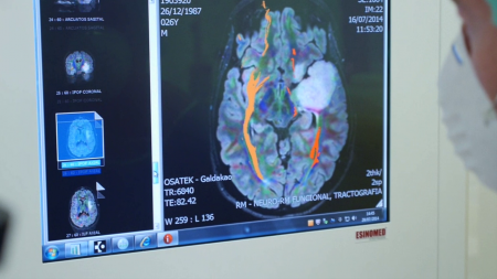 El procedimiento estándar que se emplea el del ‘paciente despierto’